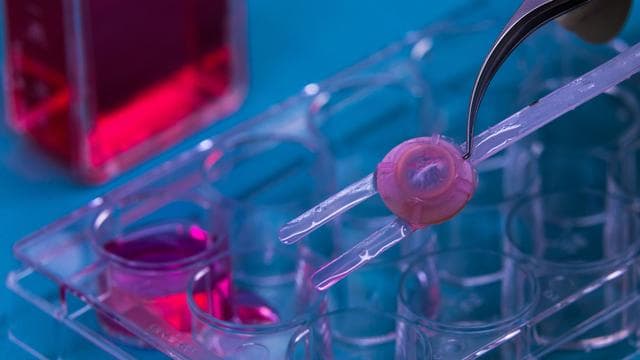Gewebespenden: Zahl der Augenhornhautspenden ist in MV leicht rückläufig